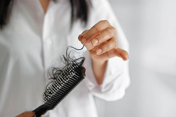 مهمترین علت ریزش مو در زنان را بشناسید